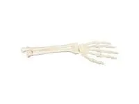 310_1018337 Рука и запястье, ORTHOBone