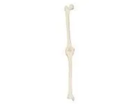 310_1018340 Колено, левое, ORTHOBone