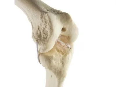 Колено, стандартное, левое, ORTHOBone