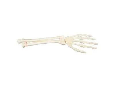 Рука и запястье, ORTHOBone