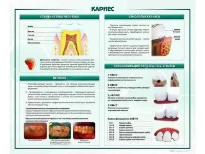 Стенд "Кариес" МУ0255