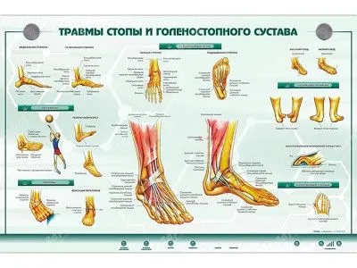 Интерактивный светодинамический стенд "Травмы стопы и голеностопного сустава"
