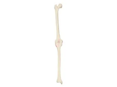 Колено, левое, ORTHOBone