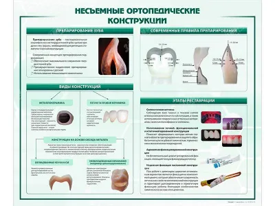 Стенд "Несъёмные ортопедические конструкции"